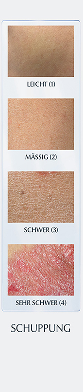 xerosimeter 3