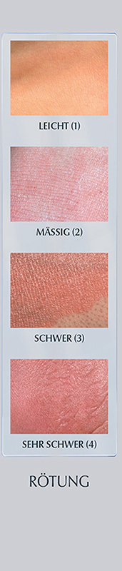 xerosimeter 5